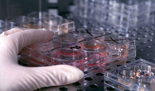 Culture trays containing human embryonic stems cells being stored in heat-controlled storage and studied by developmental biologist James Thomson's research lab.
© UW-Madison News & Public Affairs  608/262-0067
Photo by:  Jeff Miller
Date: 11/98     File#: color slide