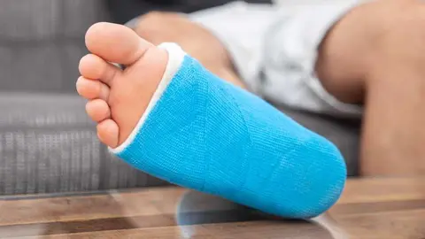 Man with broken leg in cast on couch at home. Sports injury concept.